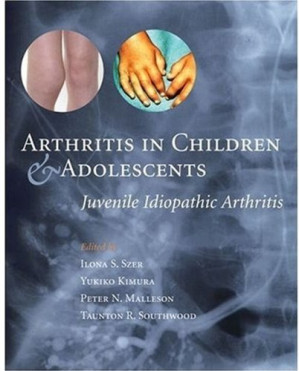 arthritis in children and adolescents juvenile idiopathic arthritis
