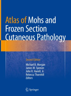 atlas of mohs and frozen section cutaneous pathology second edition