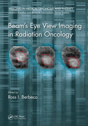 beam s eye view imaging in radiation oncology