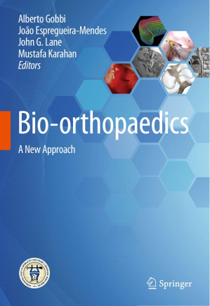 bio orthopaedics a new approach