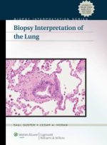biopsy interpretation of the lung