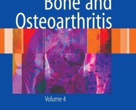 bone and osteoarthritis