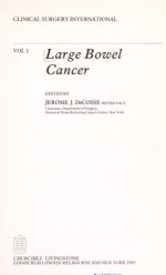 bowel cancer