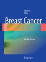 breast cancer a lobar disease