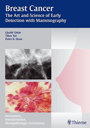 breast cancer the art and science of early detection with mammography