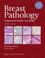 breast pathology diagnosis by needle core biopsy