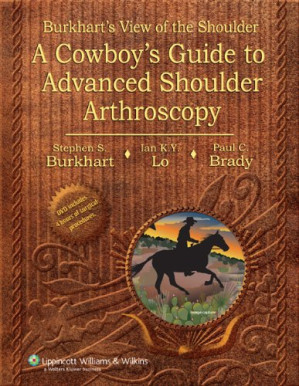 burkhart s view of the shoulder a cowboy s guide to advanced shoulder arthroscopy
