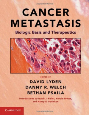 cancer metastasis biologic basis and therapeutics