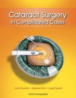 cataract surgery in complicated cases