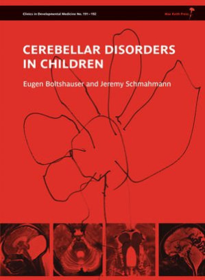 cerebellar disorders in children