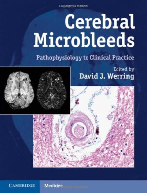 cerebral microbleeds pathophysiology to clinical practice
