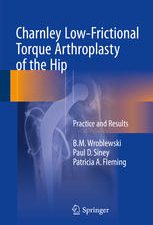 charnley low frictional torque arthroplasty of the hip practice and results
