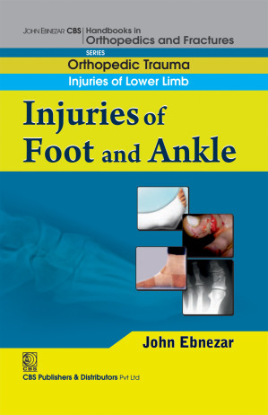 childhood disorders of the foot and lower limb