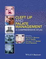 cleft lip and palate management a comprehensive atlas