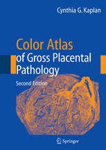 color atlas of gross placental pathology