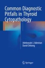 common diagnostic pitfalls in thyroid cytopathology