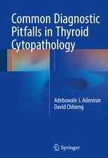 common diagnostic pitfalls in thyroid cytopathology