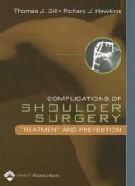 complications of shoulder surgery treatment and prevention