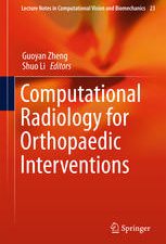 computational radiology for orthopaedic interventions