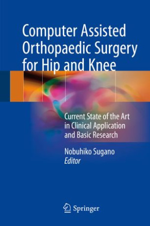 computer assisted orthopaedic surgery for hip and knee