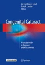 congenital cataract a concise guide to diagnosis and management