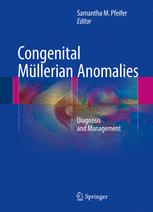 congenital m llerian anomalies diagnosis and management