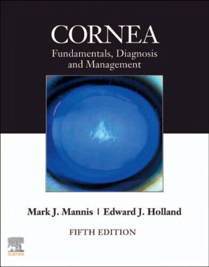 cornea 2 volume set 5th edition