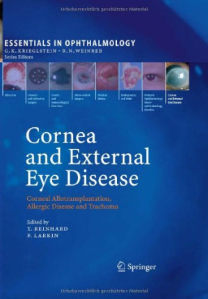 cornea and external eye disease