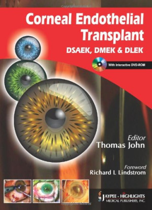 corneal endothelial transplant