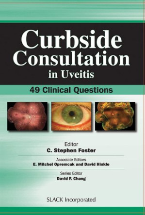 curbside consultation in uveitis 49 clinical questions curbside consultation in ophthalmology