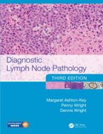 diagnostic lymph node pathology third edition