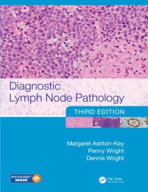 diagnostic lymph node pathology third edition