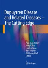 dupuytren disease and related diseases the cutting edge
