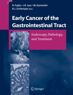 early cancer of the gastrointestinal tract