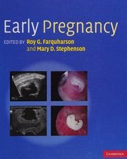early pregnancy cambridge medicine