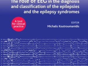 eeg and epilepsy