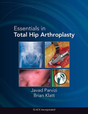 essentials in total hip arthroplasty