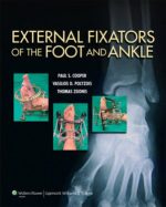 external fixators of the foot and ankle