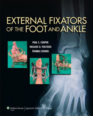 external fixators of the foot and ankle