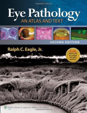 eye pathology an atlas and text 2nd edition