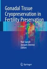 gonadal tissue cryopreservation in fertility preservation