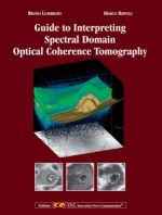 guide to interpreting spectral domain opitcal coherence tomography