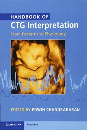 handbook of ctg interpretation from patterns to physiology april 2017 release