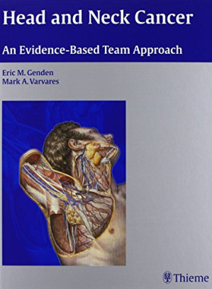 head and neck cancer an evidence based team approach