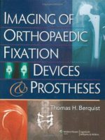 imaging of orthopaedic fixation devices and prostheses