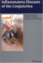 inflammatory diseases of the conjunctivae
