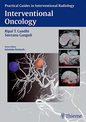 interventional oncology