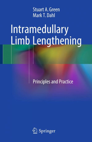 intramedullary limb lengthening principles and practice
