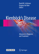 kienb ck s disease advances in diagnosis and treatment