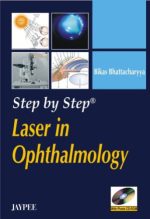 laser in ophthalmology